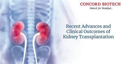 Minnesota Kidney Transplant Options at Allina Health