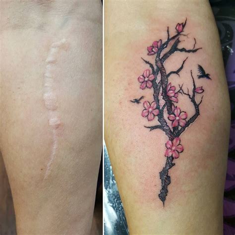 Cover Up Scars with Beautiful Tattoo Designs Forever